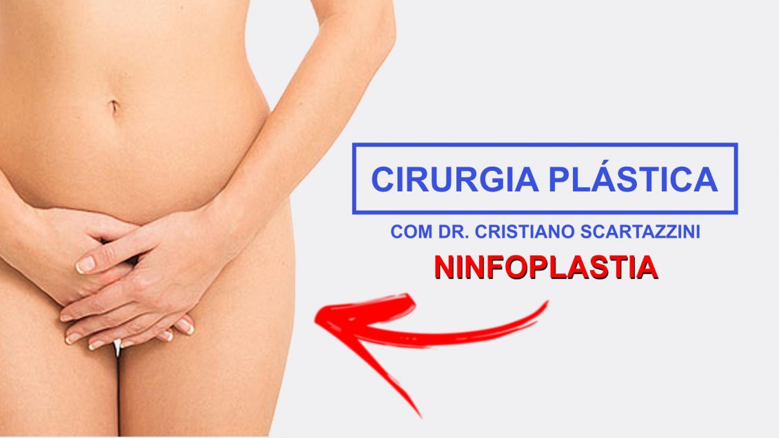 Ninfoplastia Cirurgia Pl Stica Com Dr Cristiano Scartazzini Clicrdc