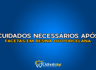 #162 Cuidados necessários após facetas em resina ou porcelana
