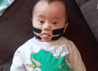 Campanha Solidária busca ajuda para capacete ortopédico de menino com síndrome de down em Chapecó