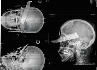 Homem é preso em flagrante por tentativa de feminicídio após golpe de faca no rosto da vítima no Oeste de SC