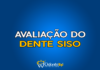 #163 Avaliação do dente siso