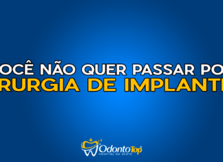 #172 Você não quer passar por cirurgia de implantes
