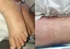 Criança é internada após suspeita de contaminação ligada a detergente