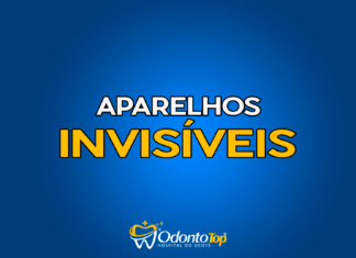 #176 Aparelhos invisíveis