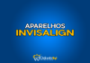#177 Aparelhos Invisalign
