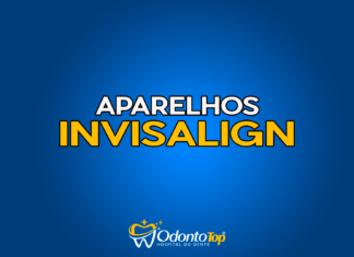 #177 Aparelhos Invisalign