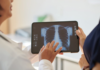 Anvisa aprova medicamento para hipertensão pulmonar
