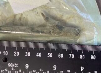 Paciente será indenizado após sair de hospital em SC com pedaço de madeira de 8 cm na perna