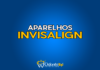 #187 Aparelhos Invisalign