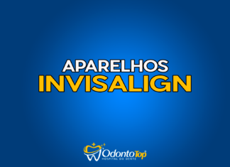 #187 Aparelhos Invisalign
