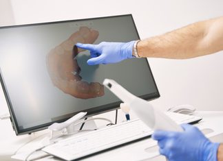 Lembra da massa na boca para fazer o molde? A ortodontia deixou isso para trás